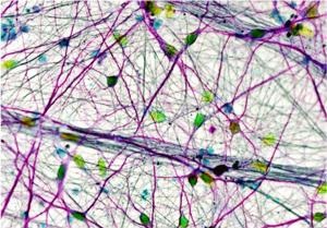 Human iPS-derived neurons