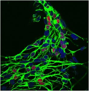 Stem cell-derived human motor neurones are being used by researchers to understand more about MND (image courtesy of Dr Scaber, University of Oxford)