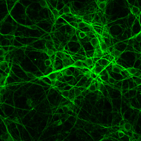 Elisabeth Jirstrom neuron photo