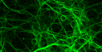 tiRNA: A Newcomer in Motor Neuron Disease