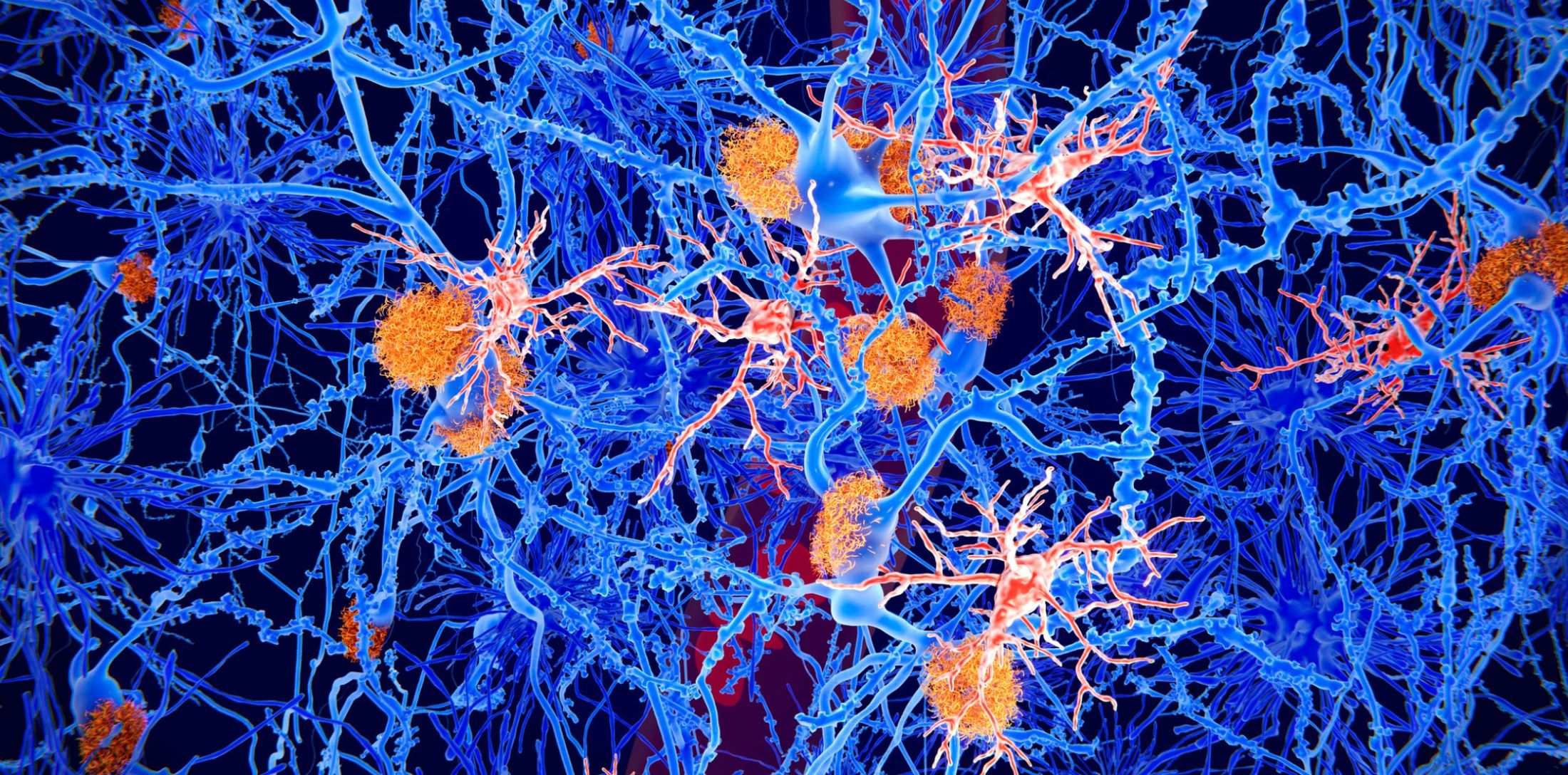 Microglia, neurons and other brain cells