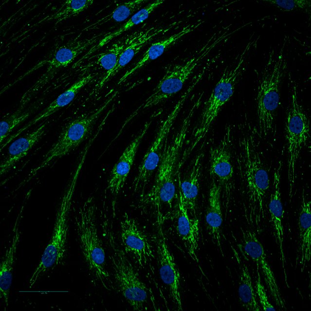 A microscope image showing skin cells, with the nucleus at the centre of each cell and the mitochondria network spreading throughout the whole cell. 