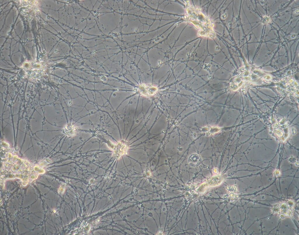 An image of motor neurons grown in a dish, taken during Libby's PhD research.