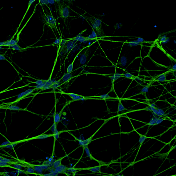 A microscope image of brain cells, with the nucleus at the centre of each cell and long, thin processes from each cell connecting with each other. 