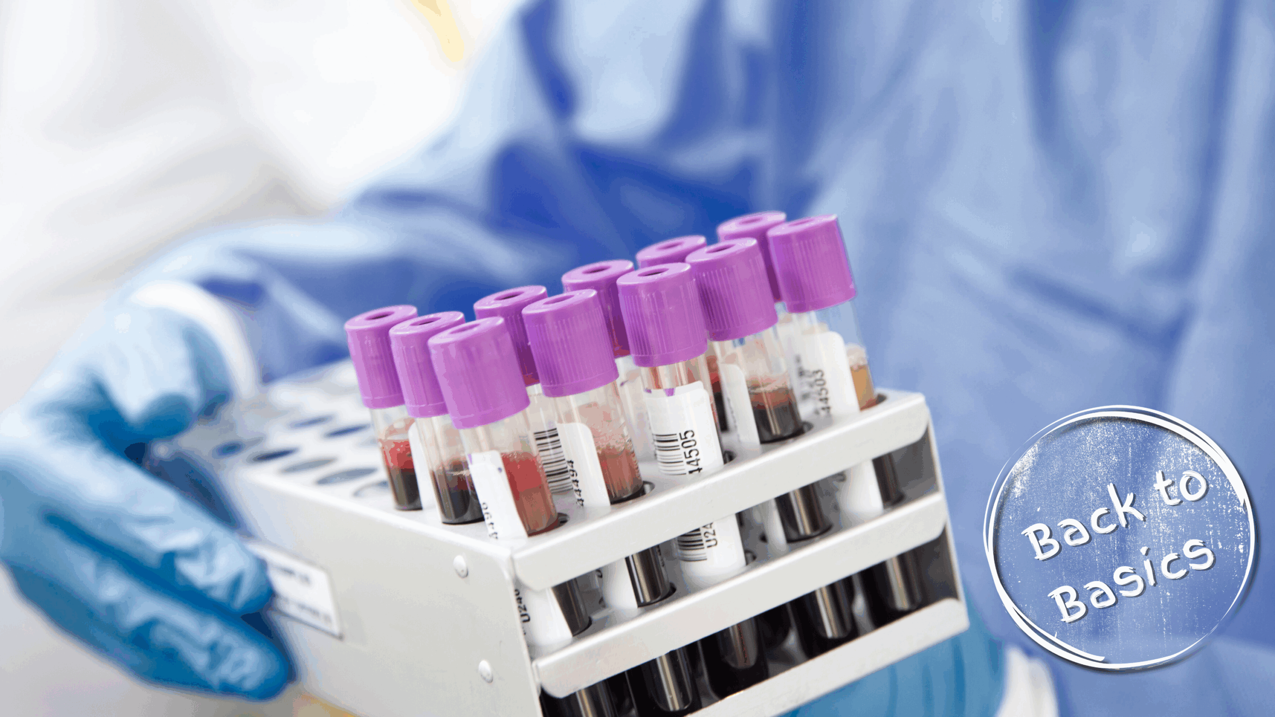 What biomarkers do we have for MND?